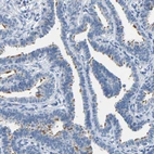 Immunohistochemical staining of human fallopian tube shows strong positivity in cilia in glandular cells.