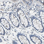 Immunohistochemical staining of human rectum shows weak cytoplasmic positivity in glandular cells.