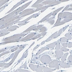 Immunohistochemical staining of human skeletal muscle shows no cytoplasmic positivity in myocytes as expected.
