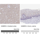 Anti-GABBR2 Antibody