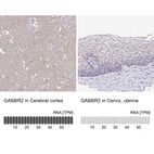 Anti-GABBR2 Antibody