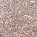 Immunohistochemical staining of human cerebellum shows strong positivity in neuronal processes in cells in granular layer.