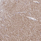 Immunohistochemical staining of human cerebellum shows strong positivity in neuronal processes in cells in granular layer.