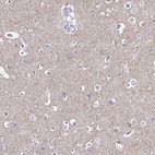 Immunohistochemical staining of human cerebral cortex shows weak cytoplasmic positivity in neuropil.