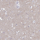 Anti-GABBR2 Antibody