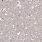 Immunohistochemical staining of human cerebral cortex shows weak cytoplasmic positivity in neuropil.