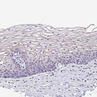 Immunohistochemical staining of human cervix shows no positivity in squamous epithelial cells as expected.