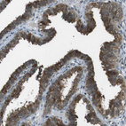 Anti-SLITRK5 Antibody