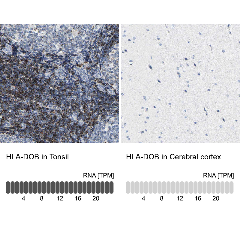 Anti-HLA-DOB Antibody