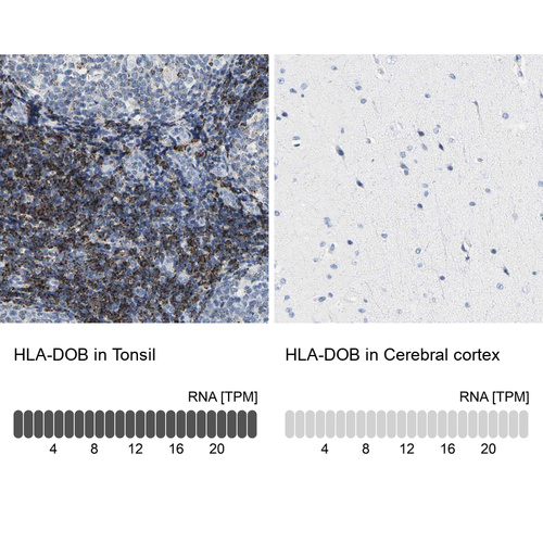 Anti-HLA-DOB Antibody