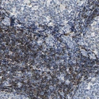 Immunohistochemical staining of human tonsil shows high expression.