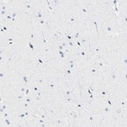 Immunohistochemical staining of human cerebral cortex shows low expression as expected.