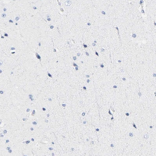 Anti-HLA-DOB Antibody