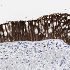 Anti-ALOX15 Antibody