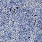 Immunohistochemical staining of human lymph node shows strong cytoplasmic positivity ina small subset of non-germinal center cells.