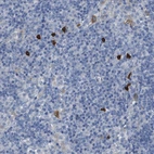 Immunohistochemical staining of human lymph node shows strong cytoplasmic positivity ina small subset of non-germinal center cells.