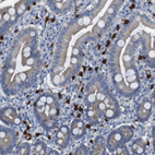 Immunohistochemical staining of human duodenum shows strong cytoplasmic positivity in lymphoid cells.