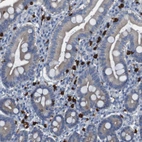 Immunohistochemical staining of human duodenum shows strong cytoplasmic positivity in lymphoid cells.