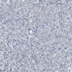 Immunohistochemical staining of human liver shows no positivity in hepatocytes as expected.