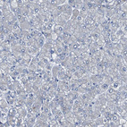 Anti-ALOX15 Antibody