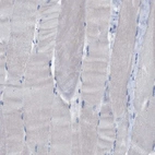 Immunohistochemical staining of human skeletal muscle shows no positivity in myocytes as expected.