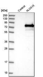 Western blot analysis in control (vector only transfected HEK293T lysate) and ALOX15 over-expression lysate (Co-expressed with a C-terminal myc-DDK tag (~3.1 kDa) in mammalian HEK293T cells, LY400456).