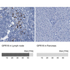 Anti-GPR18 Antibody