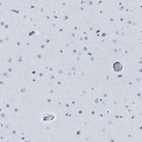 Immunohistochemical staining of human cerebral cortex shows no positivity in neurons as expected.