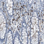Immunohistochemical staining of human rectum shows strong cytoplasmic positivity in lymphoid cells.