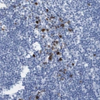 Immunohistochemical staining of human lymph node shows strong cytoplasmic/membranous positivity in non-germinal center cells.
