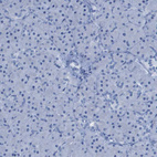 Immunohistochemical staining of human pancreas shows no positivity in exocrine glandular cells as expected.