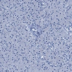 Immunohistochemical staining of human pancreas shows no positivity in exocrine glandular cells as expected.