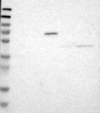 Anti-B3GNT7 Antibody