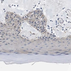 Immunohistochemical staining of human skin shows weak cytoplasmic positivity in squamous epithelial cells.