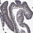 Immunohistochemical staining of human fallopian tube shows moderate cytoplasmic positivity in glandular cells.