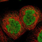 Immunofluorescent staining of human cell line A-431 shows localization to nucleoplasm.