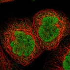 Anti-TIAM2 Antibody