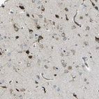 Anti-CELSR2 Antibody