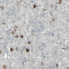 Anti-GPR19 Antibody