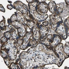 Immunohistochemical staining of human placenta shows strong granular cytoplasmic positivity in trophoblastic cells.