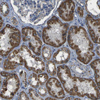 Immunohistochemical staining of human kidney shows strong granular cytoplasmic positivity in cells in tubules.