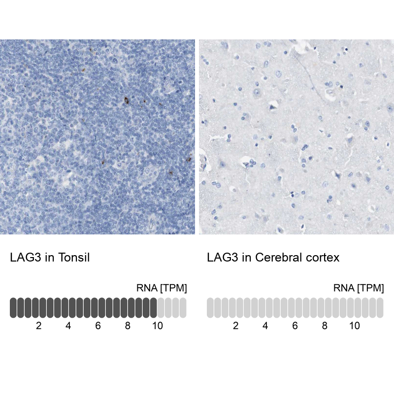 Anti-LAG3 Antibody