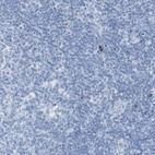 Immunohistochemical staining of human tonsil shows high expression.
