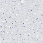 Immunohistochemical staining of human cerebral cortex shows low expression as expected.