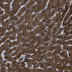 Immunohistochemical staining of human liver shows strong cytoplasmic positivity in hepatocytes.