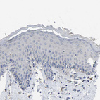 Immunohistochemical staining of human skin shows no positivity in squamous epithelial cells as expected.