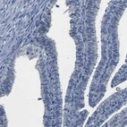Immunohistochemical staining of human Fallopian tube shows no positivity in glandular cells as expected.