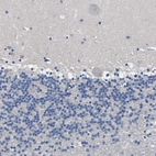 Immunohistochemical staining of human cerebellum shows no positivity in Purkinje cells as expected.