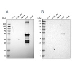 Western blot analysis using Anti-CYP2C8 antibody HPA013970 (A) shows similar pattern to independent antibody HPA013547 (B).