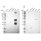 Western blot analysis using Anti-CYP2C8 antibody HPA013970 (A) shows similar pattern to independent antibody HPA013547 (B).